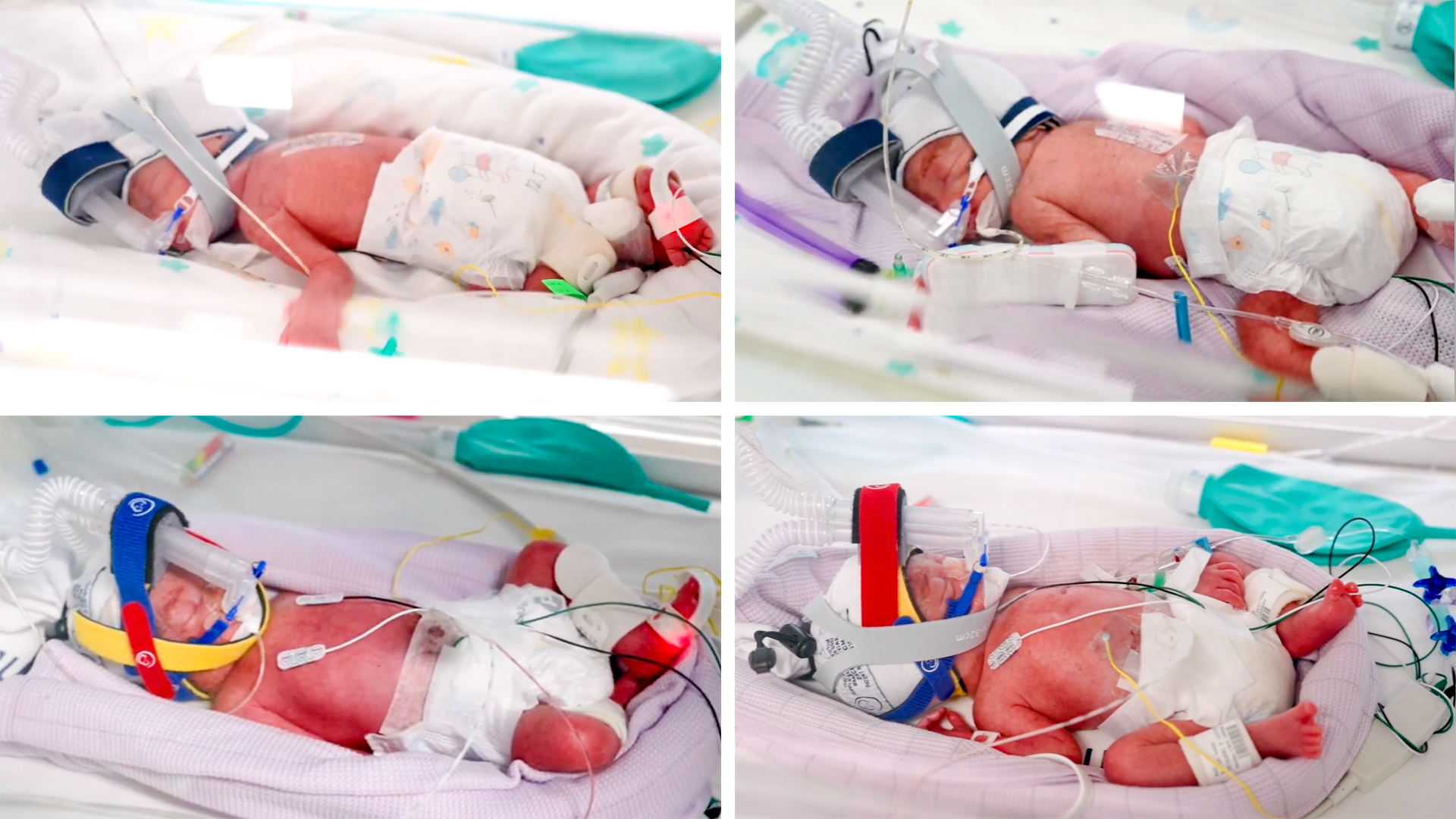 Four identical newborn girls in an incubator