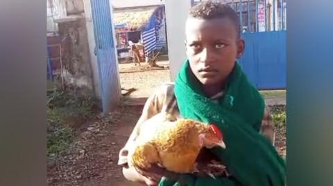12‑Year‑Old Ethiopian Boy Wins Hearts by Bringing a Sick Chicken to Hospital