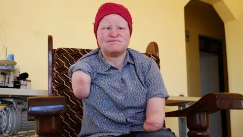 Fear and Violence: The Harrowing Reality for People with Albinism in Tanzania During Elections