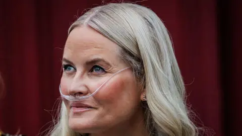 Norwegian Crown Princess Mette‑Marit's Lung Transplant Triumph